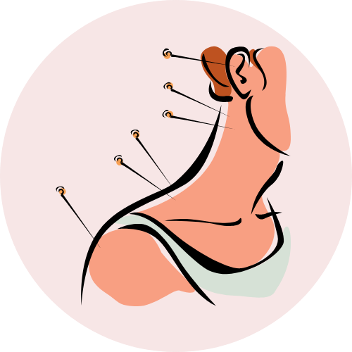 Acupuncture